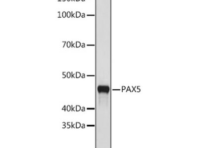 PAX5 Rabbit mAb (A9607)