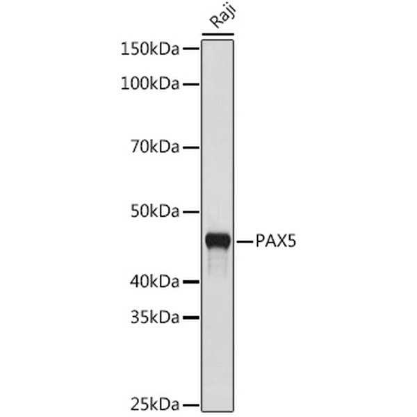 PAX5 Rabbit mAb (A9607) PAX5 Rabbit mAb (A9607)