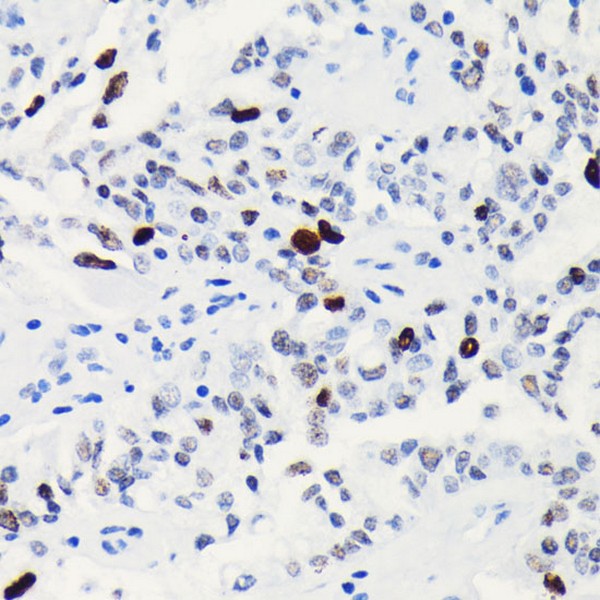 AP0002: Phospho-Histone H3-S10 Rabbit mAb