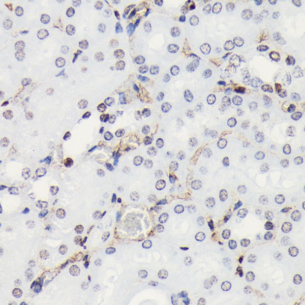 Phospho-Histone H3-S10 Rabbit mAb (Catalog Number: AP0002) Abclonal