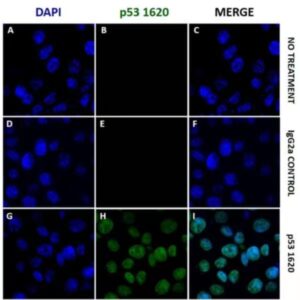 Anti-p53 WT Unconjugated(102201) catalog number：102201 Caprico Biotechnologies