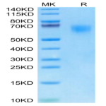 Cynomolgus TPBG/5T4 Protein (5T4-CM101)