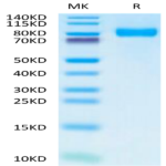 Human TPBG/5T4 Protein (5T4-HM201)