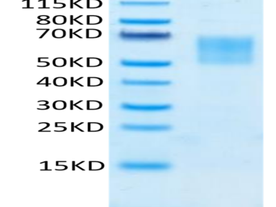 FITC-Labeled Human TPBG/5T4 Protein (5T4-HM401F)