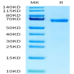Human ABO Protein (ABO-HM201)