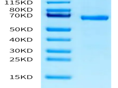 Human ABO Protein (ABO-HM201)