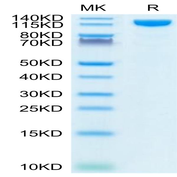Human ACE2/ACEH Protein (ACE-HM201)