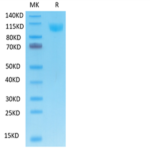 Human ACE2/ACEH Protein (ACE-HM401)