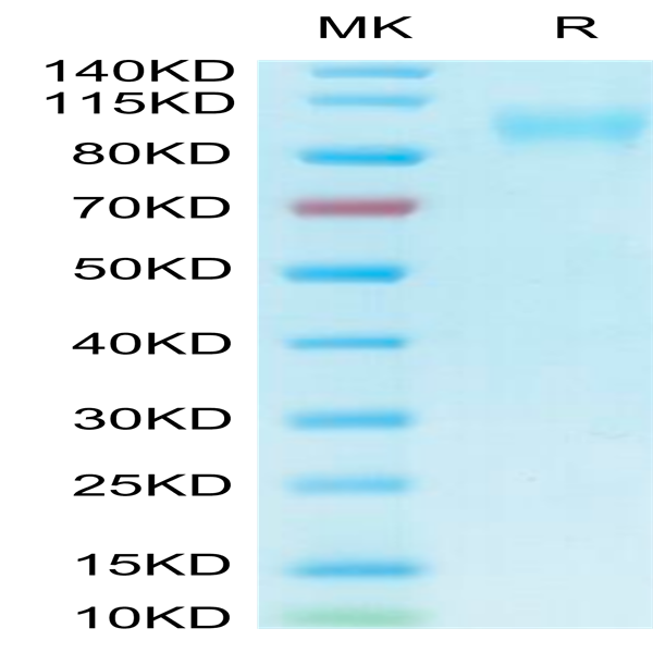 Biotinylated Human ACE2/ACEH Protein (ACE-HM401B)