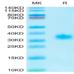 Human Adiponectin/Acrp30 Protein (ADI-HM101)