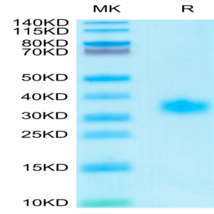 Human Adiponectin/Acrp30 Protein (ADI-HM101)