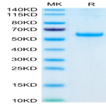 Human Adiponectin/Acrp30 Protein (ADI-HM201)