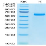 Mouse Adiponectin/Acrp30 Protein (ADI-MM201)