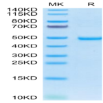 Human AREG Protein (AEG-HM201)