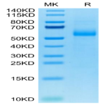 Cynomolgus AGER Protein (AER-CM101)