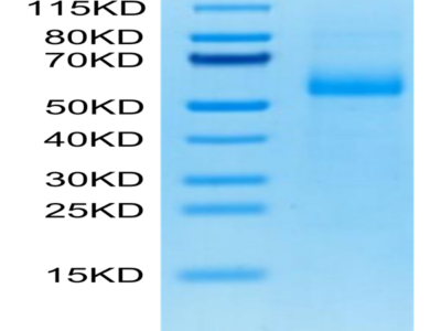 Cynomolgus AGER Protein (AER-CM101)