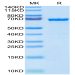 Cynomolgus AFP Protein (AFP-CM101)