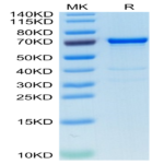 Human AFP Protein (AFP-HM101)