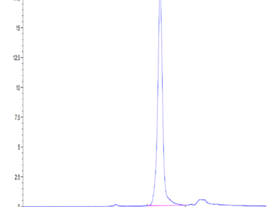 Mouse AFP Protein (AFP-MM101)