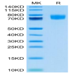 Biotinylated Human ALCAM/CD166 Protein (Primary Amine Labeling) (ALC-HM101B)