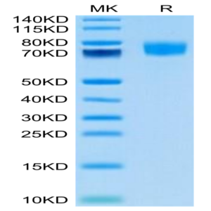 Biotinylated Human ALCAM/CD166 Protein (Primary Amine Labeling) (ALC-HM101B)