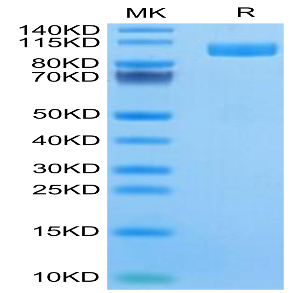 Human ALCAM/CD166 Protein (ALC-HM201)