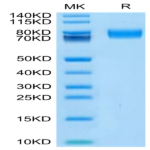 Biotinylated Human ALCAM/CD166 Protein (ALC-HM401B)