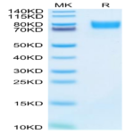 Mouse ALCAM/CD166 Protein (ALC-MM101)