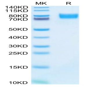 Mouse ALCAM/CD166 Protein (ALC-MM101)