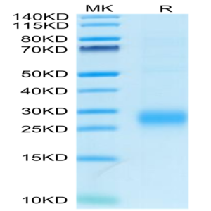 Human ALK-1/ACVRL1 Protein (ALK-HM101)
