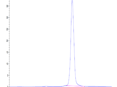 Human AMCase/CHIA Protein (AMC-HM101)