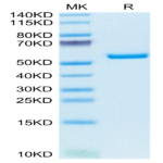 Mouse AMCase/CHIA Protein (AMC-MM101)