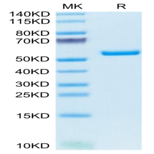 Mouse AMCase/CHIA Protein (AMC-MM101)