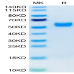 Human AMHRII Protein (AMH-HM2R2)