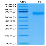 Cynomolgus AMIGO2 Protein (AMI-CM102)