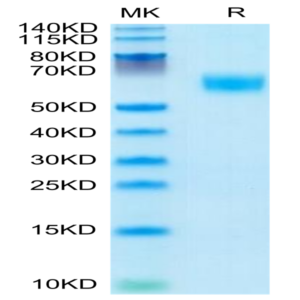 Mouse AMIGO2 Protein (AMI-MM102)