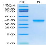 Cynomolgus ANGPTL4/Angiopoietin-like 4 Protein (ANG-CM1L4)