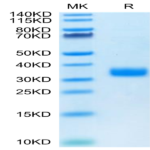 Human ANGPTL4/Angiopoietin-like 4 Protein (ANG-HM1L4)