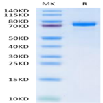 Human ANGPTL7/CDT6 Protein (ANG-HM2L7)