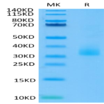 Human ANGPTL3/Angiopoietin-like 3 Protein (ANG-HM403)