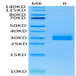 Human ANGPTL2/Angiopoietin-like 2 Protein (ANG-HM4L2)