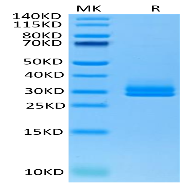Human ANGPTL2/Angiopoietin-like 2 Protein (ANG-HM4L2)