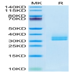 Biotinylated Human ANGPTL2/Angiopoietin-like 2 Protein (ANG-HM4L2B)