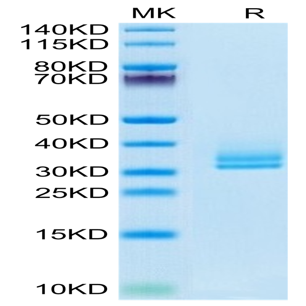 Biotinylated Human ANGPTL2/Angiopoietin-like 2 Protein (ANG-HM4L2B)