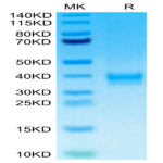 Human ANTXR2 Protein (ANT-HM1R2)