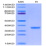 Mouse ANTXR2 Protein (ANT-MM1R2)