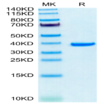 Human ANXA2 Protein (ANX-HE102)