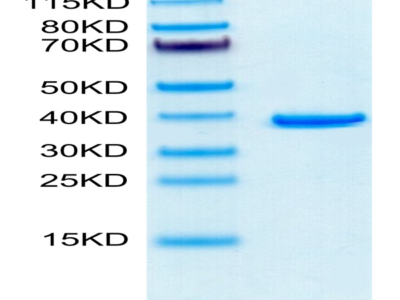 Human ANXA2 Protein (ANX-HE102)