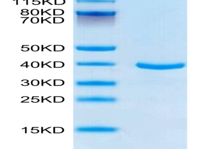 Human ANXA1 Protein (ANX-HE1A1)