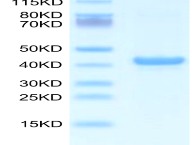 Mouse APOA5 Protein (APA-ME105)